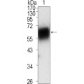 anti-HYAL1 antibody (Hyaluronidase-1) (N-Term)
