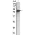 anti-HYAL1 antibody (Hyaluronidase-1) (N-Term)