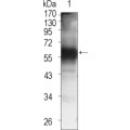 anti-HYAL1 antibody (Hyaluronidase-1) (N-Term)