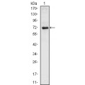anti-HYAL1 antibody (Hyaluronidase-1) (N-Term)