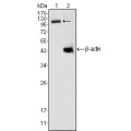 anti-HYAL1 antibody (Hyaluronidase-1) (N-Term)