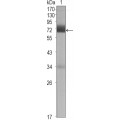 anti-HYAL1 antibody (Hyaluronidase-1) (N-Term)