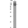 anti-HYAL1 antibody (Hyaluronidase-1) (N-Term)