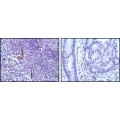 anti-HYAL1 antibody (Hyaluronidase-1) (N-Term)