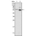 anti-HYAL1 antibody (Hyaluronidase-1) (N-Term)