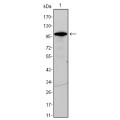 anti-HYAL1 antibody (Hyaluronidase-1) (N-Term)