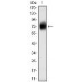 anti-HYAL1 antibody (Hyaluronidase-1) (N-Term)