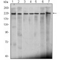 anti-HYAL1 antibody (Hyaluronidase-1) (N-Term)