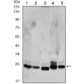 anti-HYAL1 antibody (Hyaluronidase-1) (N-Term)
