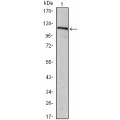 anti-HYAL1 antibody (Hyaluronidase-1) (N-Term)