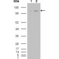 anti-HYAL1 antibody (Hyaluronidase-1) (N-Term)