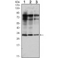 anti-HYAL1 antibody (Hyaluronidase-1) (N-Term)