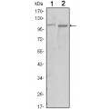 anti-HYAL1 antibody (Hyaluronidase-1) (N-Term)
