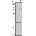 anti-HYAL1 antibody (Hyaluronidase-1) (N-Term)