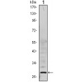 anti-HYAL1 antibody (Hyaluronidase-1) (N-Term)