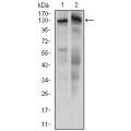 anti-HYAL1 antibody (Hyaluronidase-1) (N-Term)