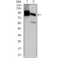 anti-HYAL1 antibody (Hyaluronidase-1) (N-Term)