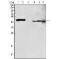 anti-HYAL1 antibody (Hyaluronidase-1) (N-Term)