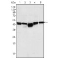 anti-HYAL1 antibody (Hyaluronidase-1) (N-Term)