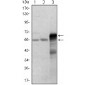 anti-HYAL1 antibody (Hyaluronidase-1) (N-Term)
