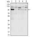 anti-HYAL1 antibody (Hyaluronidase-1) (N-Term)