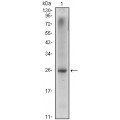 anti-HYAL1 antibody (Hyaluronidase-1) (N-Term)