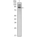 anti-HYAL1 antibody (Hyaluronidase-1) (N-Term)