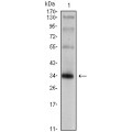 anti-HYAL1 antibody (Hyaluronidase-1) (N-Term)