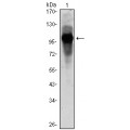 anti-HYAL1 antibody (Hyaluronidase-1) (N-Term)