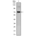 anti-HYAL1 antibody (Hyaluronidase-1) (N-Term)