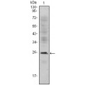 anti-HYAL1 antibody (Hyaluronidase-1) (N-Term)