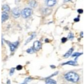 anti-HYAL1 antibody (Hyaluronidase-1) (N-Term)