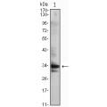 anti-HYAL1 antibody (Hyaluronidase-1) (N-Term)