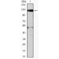 anti-HYAL1 antibody (Hyaluronidase-1) (N-Term)