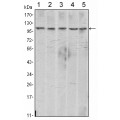anti-HYAL1 antibody (Hyaluronidase-1) (N-Term)