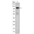 anti-HYAL1 antibody (Hyaluronidase-1) (N-Term)