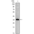 anti-HYAL1 antibody (Hyaluronidase-1) (N-Term)