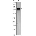 anti-HYAL1 antibody (Hyaluronidase-1) (N-Term)