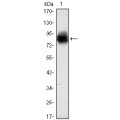 anti-HYAL1 antibody (Hyaluronidase-1) (N-Term)