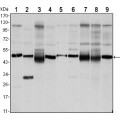 anti-HYAL1 antibody (Hyaluronidase-1) (N-Term)