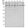 anti-HYAL1 antibody (Hyaluronidase-1) (N-Term)