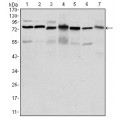 anti-HYAL1 antibody (Hyaluronidase-1) (N-Term)