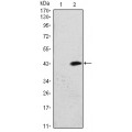 anti-HYAL1 antibody (Hyaluronidase-1) (N-Term)
