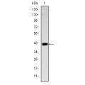 anti-HYAL1 antibody (Hyaluronidase-1) (N-Term)