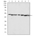 anti-HYAL1 antibody (Hyaluronidase-1) (N-Term)