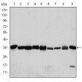 anti-HYAL1 antibody (Hyaluronidase-1) (N-Term)