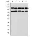 anti-HYAL1 antibody (Hyaluronidase-1) (N-Term)