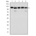 anti-HYAL1 antibody (Hyaluronidase-1) (N-Term)