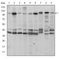 anti-HYAL1 antibody (Hyaluronidase-1) (N-Term)