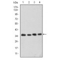 anti-HYAL1 antibody (Hyaluronidase-1) (N-Term)